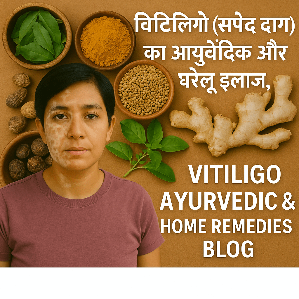विटिलिगो (सफेद दाग) का आयुर्वेदिक और घरेलू इलाज | Vitiligo Ayurvedic & Home Remedies Blog 4 1000402572